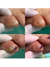 巻き爪補正店 那覇店/