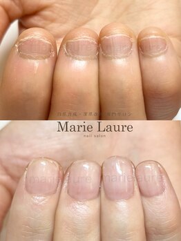 マリーロール 天王寺店(Marie Laure)/深爪矯正/自爪育成/ネイルケア
