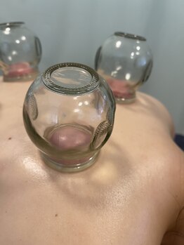 鍼灸院接骨院テトテ(tetote)/施術風景