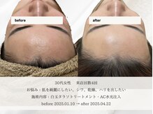 エメ 名古屋栄店(aimer)/SkinCare <肌管理・エイジング>