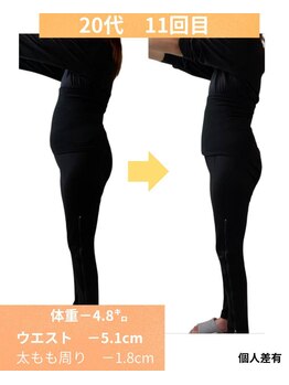 ヨサパーク ユア(YOSAPARK Yua)/11回目の施術結果