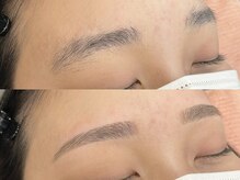 クーム(QUEUEMOU)/BeforeAfter