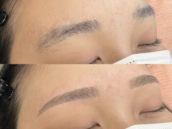 クーム(QUEUEMOU)/BeforeAfter