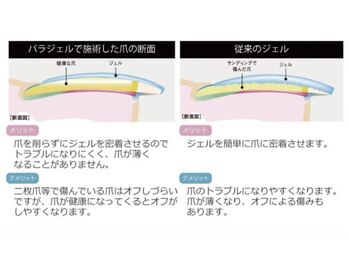ラヴィン 生駒店(Lovin)/パラジェルとは?