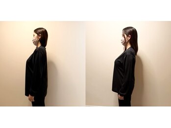 王様のきもち/巻き肩の改善例