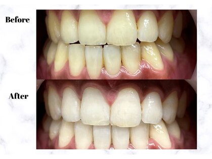 LBSホワイトニング 新宿店の写真