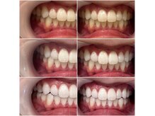 ホワイトニングショップ 霧島店の雰囲気（全国180店舗展開。結果にこだわる白さへ）