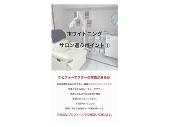 ホワイトニングショップ 越谷店/【サロン選ぶポイント1】