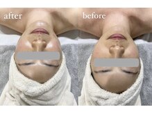 サロン スリーバイエス(salon THREE/S)/大人気◎美肌引き締めコース