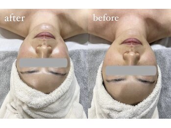 サロン スリーバイエス(salon THREE/S)/大人気◎美肌引き締めコース