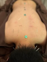 ハリマジック 代官山(HARI MAGIC)/【代官山/鍼灸/美容鍼】