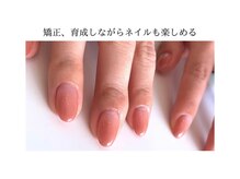 ヴェールリム(verl lim)の雰囲気（矯正中もネイルデザイン楽しめます！もちろん自爪風仕上げも可！）