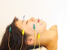 ハリランス(HARILANCE)の雰囲気（ここを改善したい、こんなお顔になりたいを鍼灸で叶えます★）
