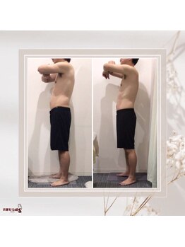 効くラボ 梅田店/3回でこの変化！筋膜リリース★