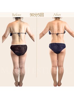 マクイエステティック 表参道店/40代ビフォーアフター