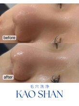 トゥインクル(Twinkle)/かつてないほどのツヤ