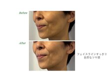 サロンラグナ(Salon Laguna)/Face お客様感想 40代女性