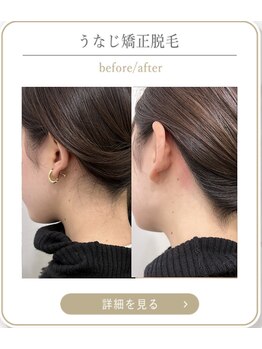 ミース 上野店/スッキリ首元が人気