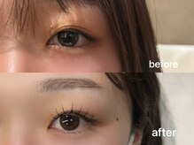 ウェヌス アイ ビューティ(VENUS eye beauty)/アンドヘルシー