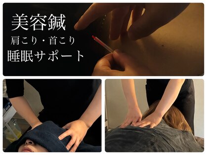 鍼灸院　楽-gaku-【肩こり/腰痛/美容鍼/小顔矯正】【8/1 NEW OPEN（予定）】の写真