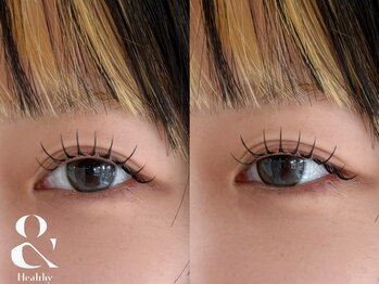 フィグ(fig)の写真/《まつげパーマ×マツエク》アンドヘルシーで垢抜け目元へ