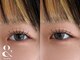 フィグ(fig)の写真/《まつげパーマ×マツエク》アンドヘルシーで垢抜け目元へ