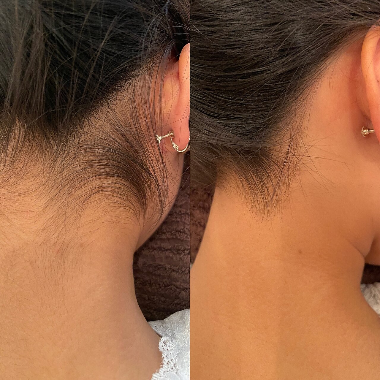 【うなじ魅せ脱毛】人気急上昇♪デザイン、シェービング込み\3500