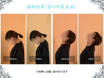 ボディ リセット アンド デザイン(Body Reset & Design)/【施術例】ビフォーアフター