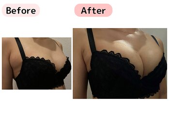 ピーグランディ 栄店(p-Grandi)/【お悩み】バストのボリューム