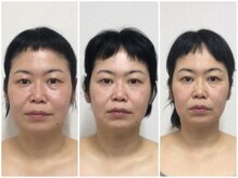 キュット(Qtto)の雰囲気（むくみや二重顎、たるみ改善など、あらゆる悩みに対応◎）