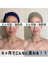 お顔の研究所/ビフォーアフター写真♪