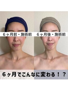 お顔の研究所/ビフォーアフター写真♪