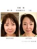 【体の美容鍼/頭蓋骨正コース70分】　20,000円→
