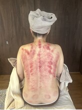 リュクス(Luxe)/赤いのに痛みを伴わない不思議