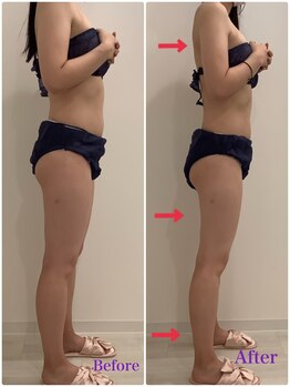 スペチアーレ 夙川/4SET最強痩身で大変身