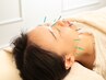＊３０日以内の再来の方＊　美容鍼コース　≪１０分延長サービス付き≫　70分