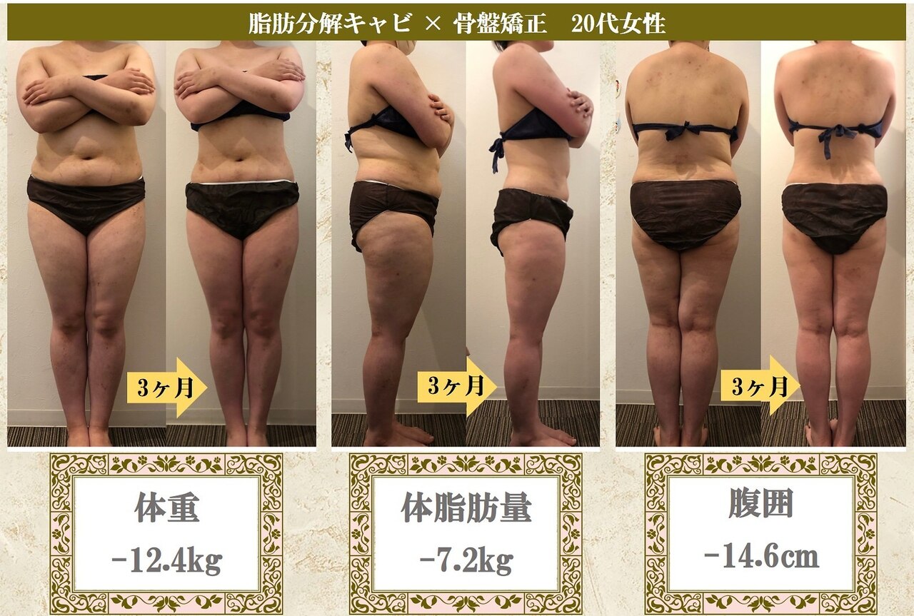 ラジオ波 キャビテーション 体験に関するサロン Beauty salon Lino