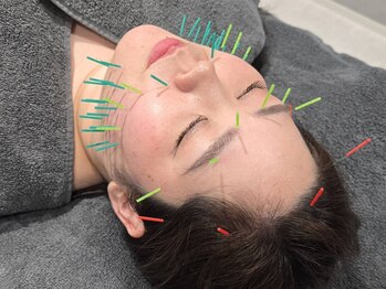 ミトノウ(MITONOU)/MITONOU式輪郭美人鍼