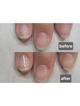 爪の悩みを解消できる（ケア含む）