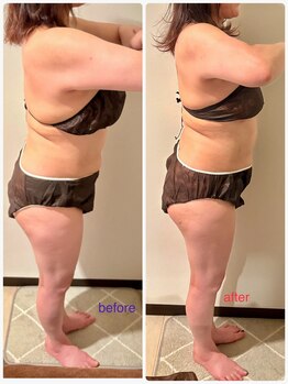 フーガ 宇都宮店(fu-ga)/やみつき 美骨リンパマッサージ