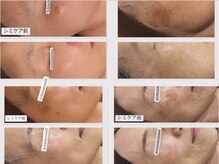 おうちサロン シュシュルーム