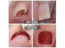 プリティア クリアモエ(Pritia clear moe)の雰囲気（一度で実感できる巻き爪矯正が人気◎）