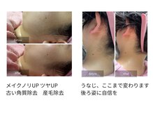 お顔そりルーム ツリー(Tree)の雰囲気（シェービングでお肌の土台作り◎うなじケアも◎）