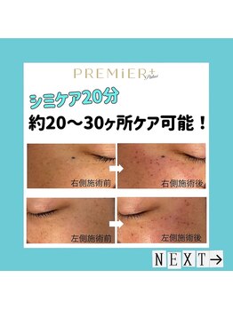 プルミエプラス 恵比寿店(PREMiER+)/【恵比寿/渋谷/シミケア】