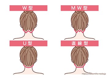 キング アンド クイーン(King&Queen)/うなじ美人 #脱毛