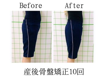 のぞみ整骨院/【産後の気になるお腹引き締め】