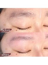 レアレア(Lea lea)/美眉Wax BeforeAfter