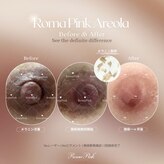 エクシアホワイトニング 本山店