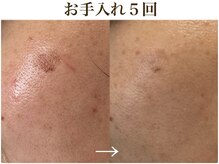 シェリー(cherie)/頑固なシミもOK