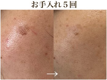 シェリー(cherie)/頑固なシミもOK